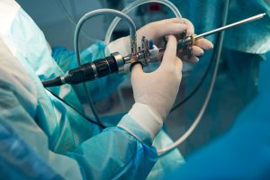 Doctor holding endoscope used for spine surgery